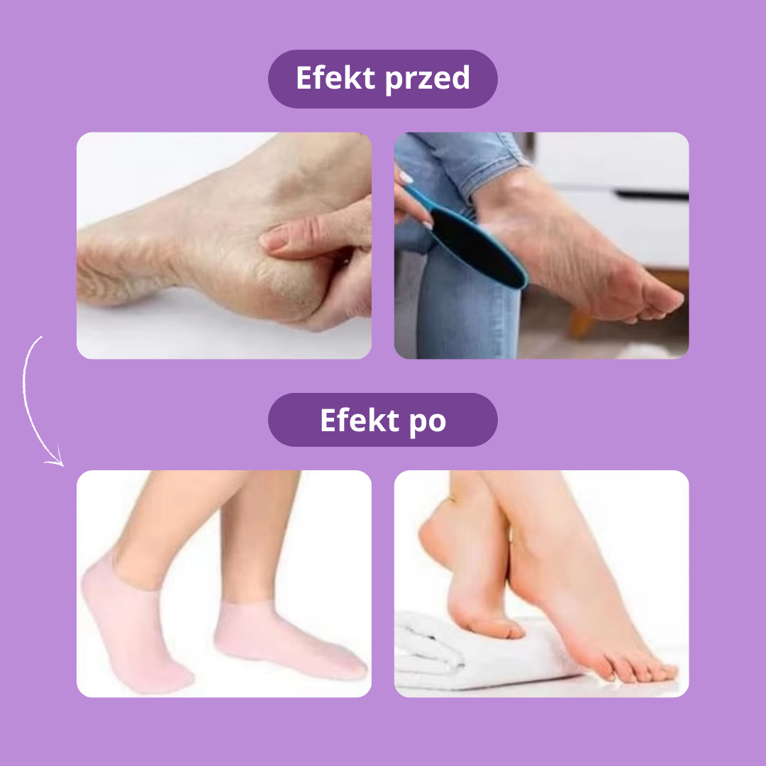 GlowFeet - skarpetki utrzymujące zdrowe i zadbane stopy