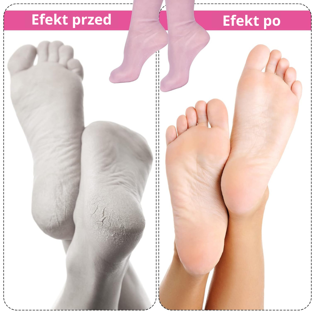 GlowFeet - skarpetki utrzymujące zdrowe i zadbane stopy