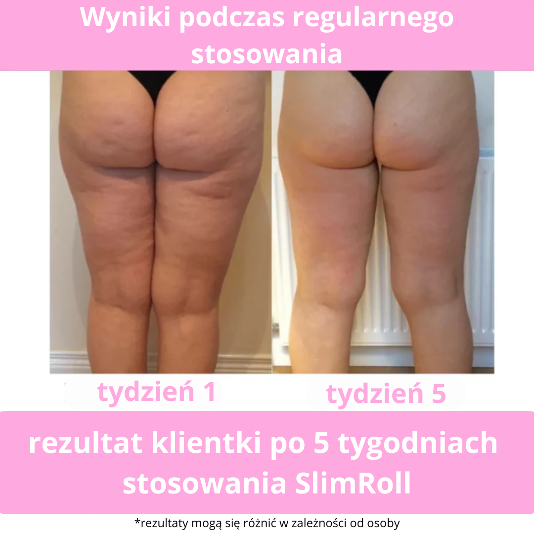 Masażer antycellulitowy SlimRoll 3w1 - 20 minut dziennie by pozbyć się cellulitu