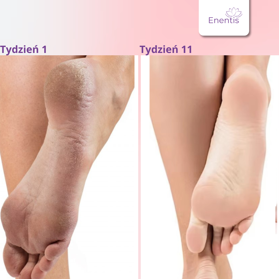 Skarpetki GlowFeet - zdrowe i nawilżone stopy od pierwszego użycia